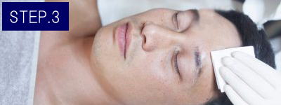 うなじ脱毛Step3